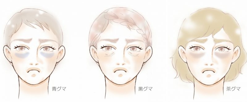 小顔 ニキビ ほうれい線など 美容鍼のお顔の効果ベスト12 美容鍼サロン 麻布ハリーク